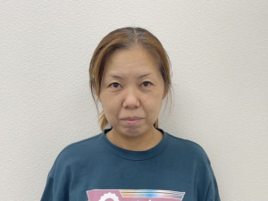 美容鍼,美容鍼灸,岡山市,倉敷市