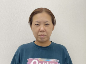美容鍼,美容鍼灸,岡山市,倉敷市